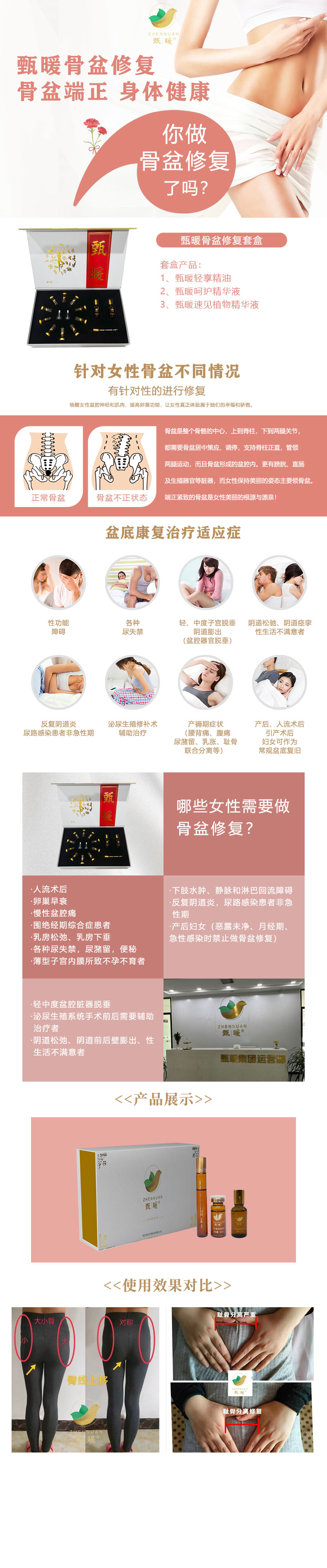 骨盆.jpg